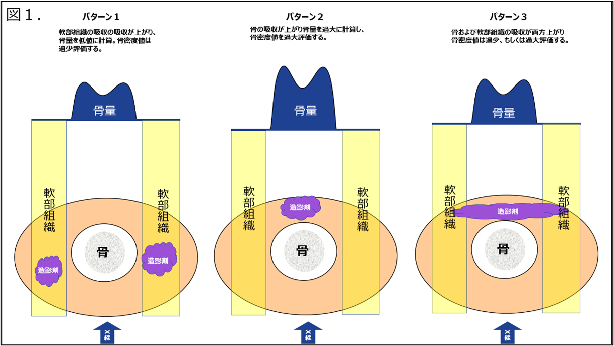 Technical Tips_contrast agent01.png